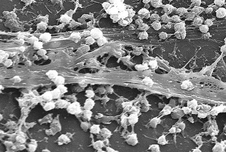  Staphylococcus aureus biofilm.